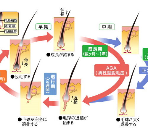 「AGA」発症のメカニズムとは？