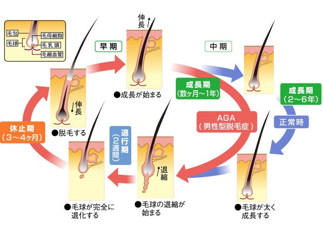 「AGA」発症のメカニズムとは？