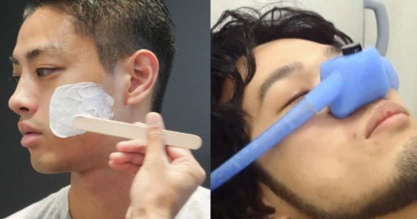 ヒゲ脱毛はモテに効く？“全部ツルツル”はもう古い！最新トレンド＆医師のリアル解説
