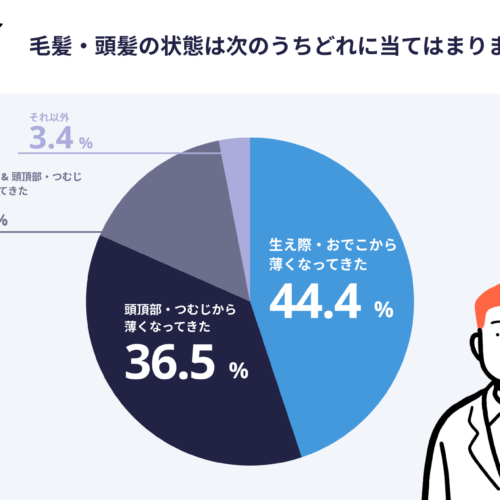 薄毛の悩みは「生え際」「つむじ」など、見た目で気づきやすい部位から